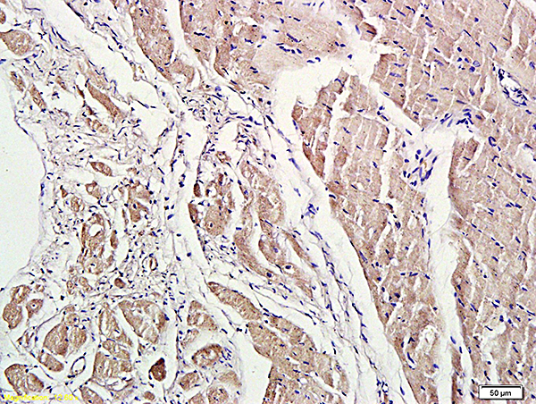 Formalin-fixed and paraffin embedded rat heart labeled with Anti-ROCK1 Polyclonal Antibody, Unconjugated (bs-1166R) at 1:200 followed by conjugation to the secondary antibody and DAB staining.