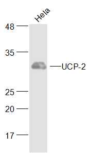 Hela cell lysates probed with UCP-2 Polyclonal Antibody, Unconjugated (bs-20750R) at 1:500 dilution and 4˚C overnight incubation. Followed by conjugated secondary antibody incubation at 1:20000 for 60 min at 37˚C.