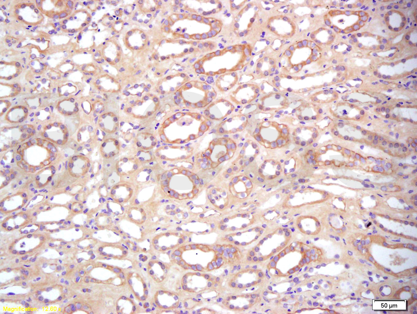 Paraformaldehyde-fixed, paraffin embedded Human Kidney Tissue; Antigen retrieval by boiling in sodium citrate buffer (pH6) for 15 minutes; Block endogenous peroxidase by 3% hydrogen peroxide for 30 minutes; Blocking buffer (normal goat serum) at 37°C for 20 minutes; Antibody incubation with BAMBI Polyclonal Antibody, Unconjugated (bs-12418R) at 1:200 overnight at 4°C, followed by a conjugated secondary antibody and DAB staining.