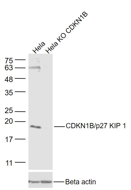 Lane 1: Hela cell lysates; Lane 2: Hela KO CDKN1B lysates probed with CDKN1B Polyclonal Antibody, Unconjugated (bs-0742R) at 1:1000 dilution and 4˚C overnight incubation. Followed by conjugated secondary antibody incubation at 1:20000 for 60 min at 37˚C.