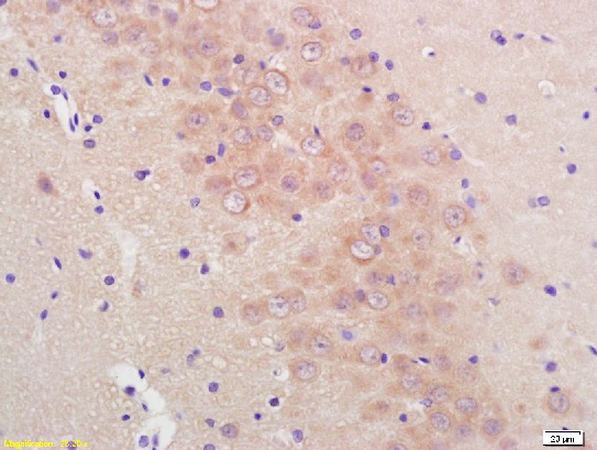 Formalin-fixed and paraffin embedded rat brain labeled with Anti-Phospho-Mcl1 (Ser159/Thr163)Polyclonal Antibody, Unconjugated (bs-3265R) at 1:200, followed by conjugation to the secondary antibody and DAB staining