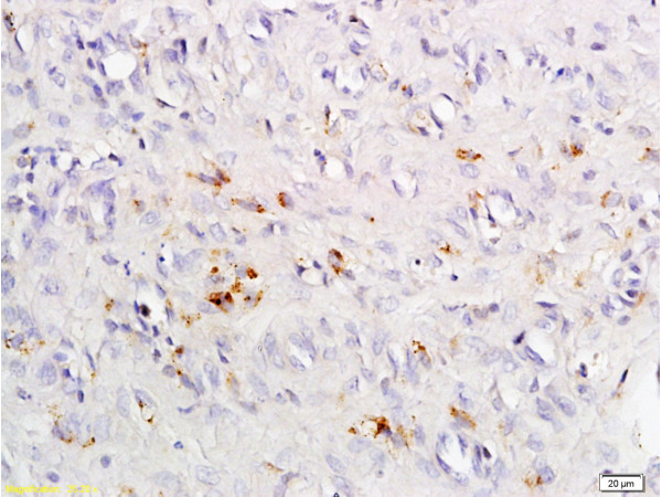 Formalin-fixed and paraffin embedded rat exfoliated cells tissue labeled with Anti-CCR4 Polyclonal Antibody, Unconjugated (bs-1168R) at 1:200 followed by conjugation to the secondary antibody and DAB staining