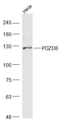 Human Hela Cell lysate (30ug), probed with PDZD8 Polyclonal Antibody, Unconjugated (bs-9043R) at 1:1000 overnight at 4˚C. Followed by incubation with secondary antibody at 1:20000 for 90min at 37C. Human Hela Cell lysate (30ug), probed with PDZD8 Polyclonal Antibody, Unconjugated (bs-9043R) at 1:1000 overnight at 4˚C. Followed by incubation with secondary antibody at 1:20000 for 90min at 37C.