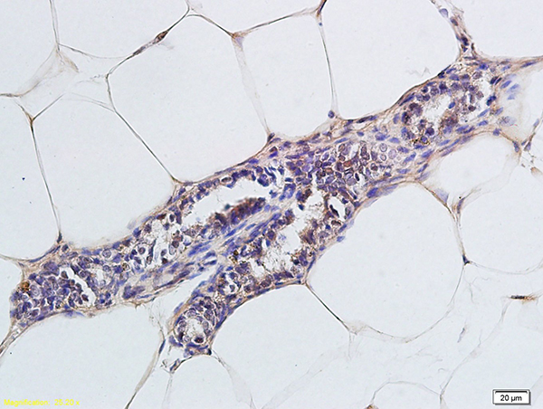 Formalin-fixed and paraffin embedded rat cells labeled with Anti-CCR4/CD194 Polyclonal Antibody, Unconjugated (bs-1168R) followed by conjugation to the secondary antibody and DAB staining