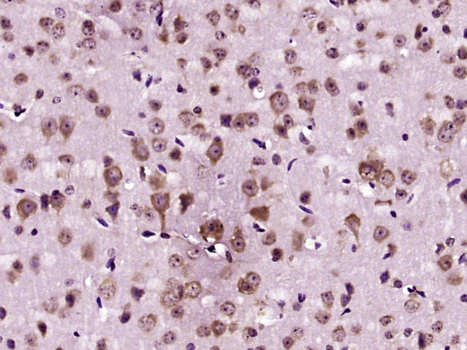 Paraformaldehyde-fixed, paraffin embedded Mouse brain; Antigen retrieval by boiling in sodium citrate buffer (pH6.0) for 15min; Block endogenous peroxidase by 3% hydrogen peroxide for 20 minutes; Blocking buffer (normal goat serum) at 37°C for 30min; Antibody incubation with AANAT Polyclonal Antibody, Unconjugated (bs-3914R) at 1:400 overnight at 4°C, DAB staining.