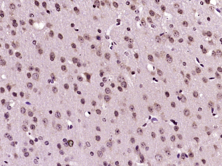 Paraformaldehyde-fixed, paraffin embedded Mouse brain; Antigen retrieval by boiling in sodium citrate buffer (pH6.0) for 15min; Block endogenous peroxidase by 3% hydrogen peroxide for 20 minutes; Blocking buffer (normal goat serum) at 37°C for 30min; Antibody incubation with OPRS1 Polyclonal Antibody, Unconjugated (bs-5111R) at 1:400 overnight at 4°C, DAB staining.
