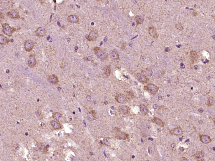 Paraformaldehyde-fixed, paraffin embedded Rat brain; Antigen retrieval by boiling in sodium citrate buffer (pH6.0) for 15min; Block endogenous peroxidase by 3% hydrogen peroxide for 20 minutes; Blocking buffer (normal goat serum) at 37°C for 30min; Antibody incubation with GADD153 (Ser30) Polyclonal Antibody, Unconjugated (bs-5177R) at 1:400 overnight at 4°C, DAB staining.