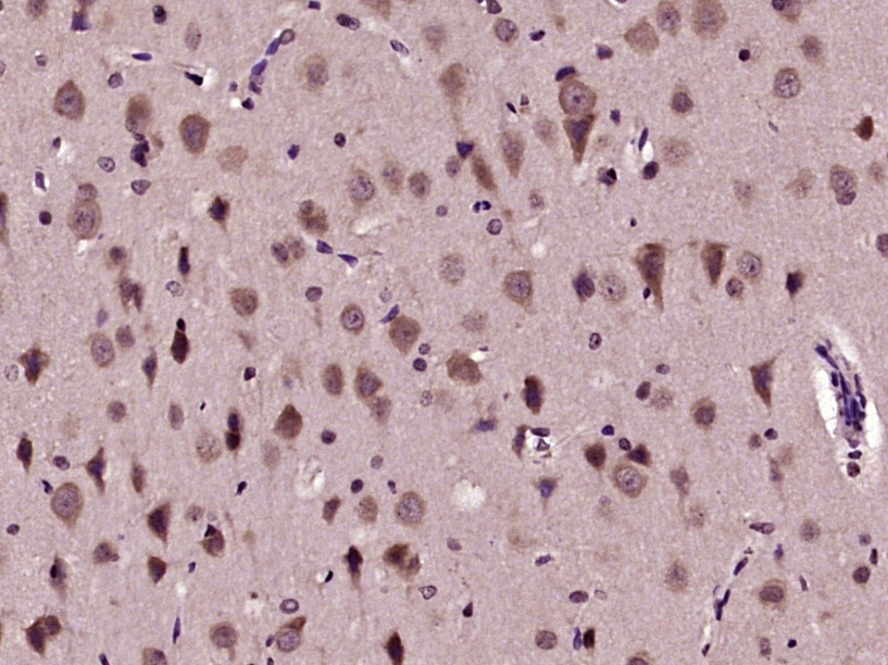 Paraformaldehyde-fixed, paraffin embedded Rat brain; Antigen retrieval by boiling in sodium citrate buffer (pH6.0) for 15min; Block endogenous peroxidase by 3% hydrogen peroxide for 20 minutes; Blocking buffer (normal goat serum) at 37°C for 30min; Antibody incubation with AKT1(Ser129) Polyclonal Antibody, Unconjugated (bs-5188R) at 1:400 overnight at 4°C, DAB staining.