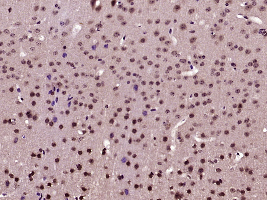 Paraformaldehyde-fixed, paraffin embedded Mouse brain; Antigen retrieval by boiling in sodium citrate buffer (pH6.0) for 15min; Block endogenous peroxidase by 3% hydrogen peroxide for 20 minutes; Blocking buffer (normal goat serum) at 37°C for 30min; Antibody incubation with AKT1(Ser129) Polyclonal Antibody, Unconjugated (bs-5188R) at 1:400 overnight at 4°C, DAB staining.