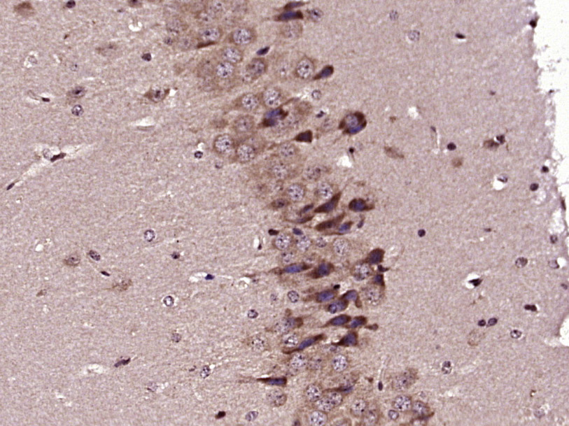 Paraformaldehyde-fixed, paraffin embedded Mouse brain; Antigen retrieval by boiling in sodium citrate buffer (pH6.0) for 15min; Block endogenous peroxidase by 3% hydrogen peroxide for 20 minutes; Blocking buffer (normal goat serum) at 37°C for 30min; Antibody incubation with SPON1 Polyclonal Antibody, Unconjugated (bs-7520R) at 1:400 overnight at 4°C, DAB staining.
