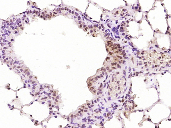 Paraformaldehyde-fixed, paraffin embedded Mouse lung; Antigen retrieval by boiling in sodium citrate buffer (pH6.0) for 15min; Block endogenous peroxidase by 3% hydrogen peroxide for 20 minutes; Blocking buffer (normal goat serum) at 37°C for 30min; Antibody incubation with MND1 Polyclonal Antibody, Unconjugated (bs-7799R) at 1:400 overnight at 4°C, DAB staining.