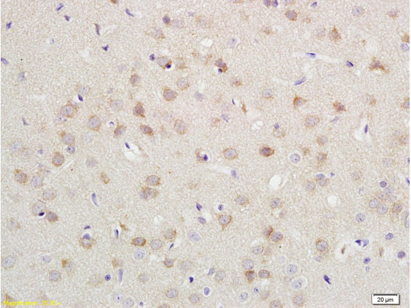 Formalin-fixed and paraffin embedded rat brain labeled with Anti-CDH2\/N-cadherin Polyclonal Antibody, Unconjugated (bs-1172R) at 1:200 followed by conjugation to the secondary antibody and DAB staining.