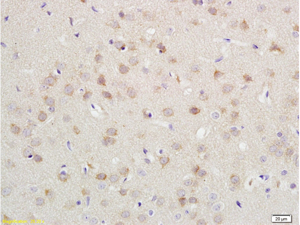 Formalin-fixed and paraffin embedded rat brain labeled with Anti-CDH2/N-cadherin Polyclonal Antibody, Unconjugated (bs-1172R) at 1:200 followed by conjugation to the secondary antibody and DAB staining.