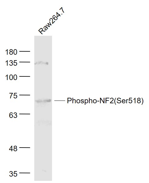 Raw264.7 cell lysates probed with Phospho-NF2 (Ser518) Polyclonal Antibody, Unconjugated (bs-3291R) at 1:1000 dilution and 4˚C overnight incubation. Followed by conjugated secondary antibody incubation at 1:20000 for 60 min at 37˚C.