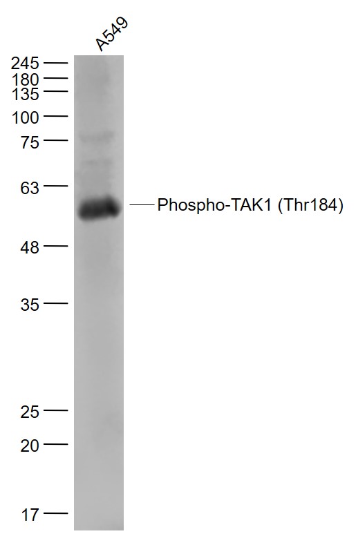 A549 cell lysates probed with Phospho-TAK1 (Thr184) Polyclonal Antibody, Unconjugated (bs-3436R) at 1:1000 dilution and 4˚C overnight incubation. Followed by conjugated secondary antibody incubation at 1:20000 for 60 min at 37˚C.