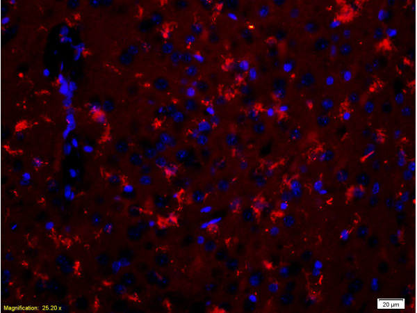 Formalin-fixed and paraffin-embedded rat brain labeled with Anti-CDH2/N-cadherin Polyclonal Antibody, Unconjugated(bs-1172R) 1:200, overnight at 4°C, The secondary antibody was Goat Anti-Rabbit IgG, PE conjugated(bs-0295G-PE)used at 1:200 dilution for 40 minutes at 37°C.