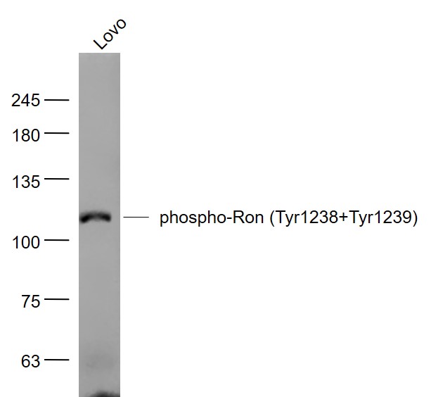Lovo cell lysates probed with phospho-Ron (Tyr1238+Tyr1239) Polyclonal Antibody, Unconjugated (bs-7537R) at 1:1000 dilution and 4˚C overnight incubation. Followed by conjugated secondary antibody incubation at 1:20000 for 60 min at 37˚C.