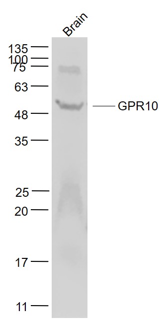 Mouse cerebrum lysates probed with GPR10 Polyclonal Antibody, Unconjugated (bs-11803R) at 1:1000 dilution and 4˚C overnight incubation. Followed by conjugated secondary antibody incubation at 1:20000 for 60 min at 37˚C.