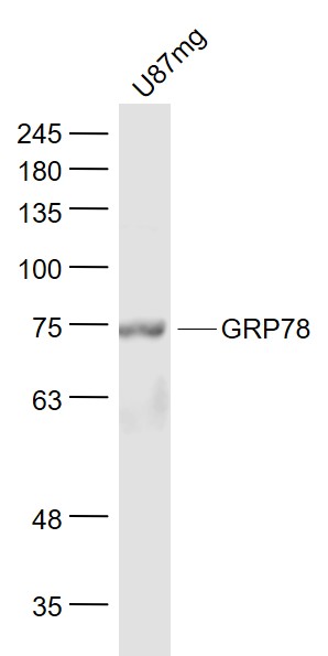 U87MG cell lysates probed with GRP78 Polyclonal Antibody, Unconjugated (bs-1219R) at 1:1000 dilution and 4˚C overnight incubation. Followed by conjugated secondary antibody incubation at 1:20000 for 60 min at 37˚C.