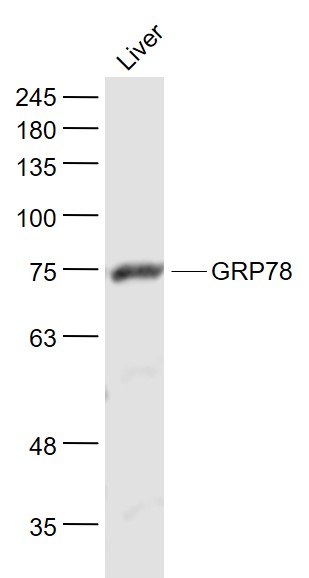 Rat Liver lysates probed with GRP78 Polyclonal Antibody, Unconjugated (bs-1219R) at 1:1000 dilution and 4˚C overnight incubation. Followed by conjugated secondary antibody incubation at 1:20000 for 60 min at 37˚C.
