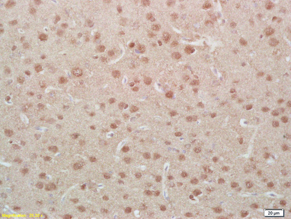 Formalin-fixed and paraffin embedded rat brain labeled with Anti-Phospho-MEF2A (Ser408)Polyclonal Antibody, Unconjugated (bs-3268R) at 1:200, followed by conjugation to the secondary antibody and DAB staining