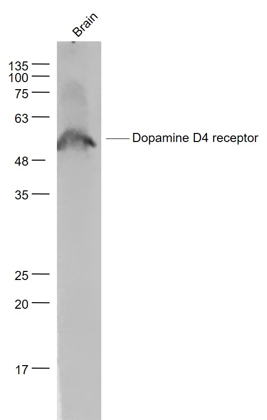Mouse Cerebrum lysates probed with DRD4 Polyclonal Antibody, Unconjugated (bs-1746R) at 1:1000 dilution and 4˚C overnight incubation. Followed by conjugated secondary antibody incubation at 1:20000 for 60 min at 37˚C. Mouse Cerebrum lysates probed with DRD4 Polyclonal Antibody, Unconjugated (bs-1746R) at 1:1000 dilution and 4˚C overnight incubation. Followed by conjugated secondary antibody incubation at 1:20000 for 60 min at 37˚C.