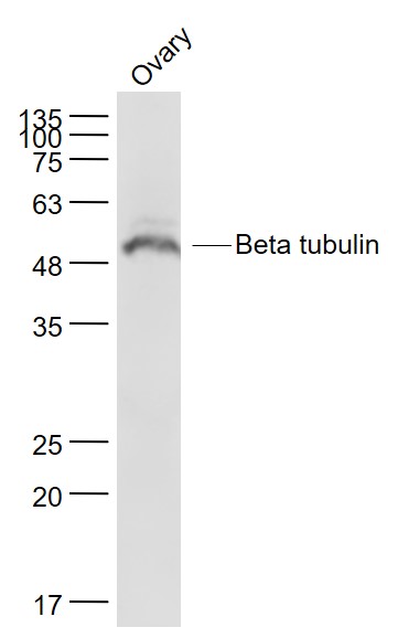 Mouse ovary lysates probed with Beta tubulin Polyclonal Antibody, Unconjugated (bs-4511R) at 1:1000 dilution and 4˚C overnight incubation. Followed by conjugated secondary antibody incubation at 1:20000 for 60 min at 37˚C.