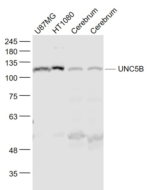 Lane 1: U87MG cell lysates;Lane 2: HT1080 cell lysates; Lane 3: Mouse Cerebrum lysates; Lane 4: Rat cerebrum lysates probed with UNC5B Polyclonal Antibody, Unconjugated (bs-7537R) at 1:1000 dilution and 4˚C overnight incubation. Followed by conjugated secondary antibody incubation at 1:20000 for 60 min at 37˚C.