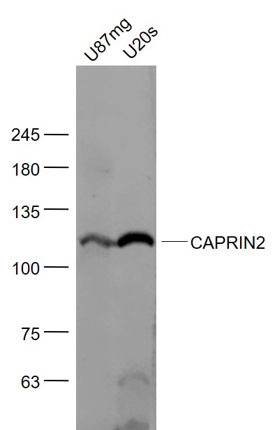 Lane 1: U87MG cell lysates; Lane 2: U2OS cell lysates probed with CAPRIN2 Polyclonal Antibody, Unconjugated (bs-12423R) at 1:1000 dilution and 4˚C overnight incubation. Followed by conjugated secondary antibody incubation at 1:20000 for 60 min at 37˚C.