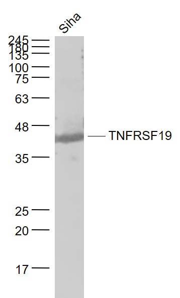Siha cell lysates probed with TNFRSF19 Polyclonal Antibody, Unconjugated (bs-3852R) at 1:1000 dilution and 4˚C overnight incubation. Followed by conjugated secondary antibody incubation at 1:20000 for 60 min at 37˚C.