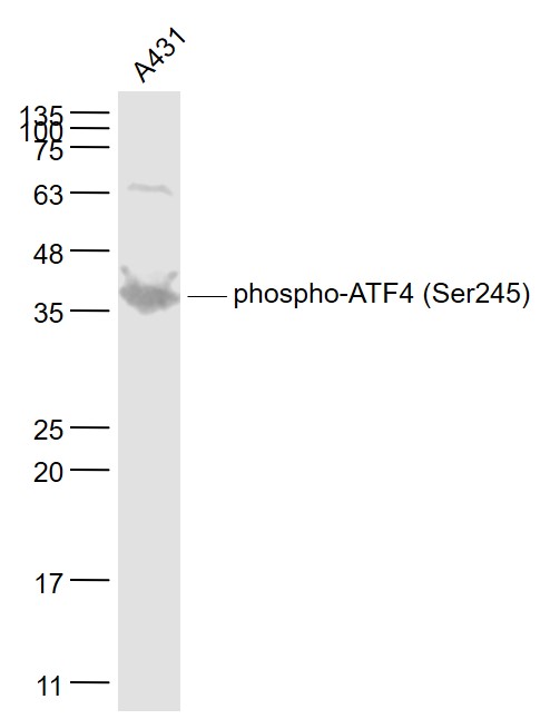 A431 cell lysates probed with ATF4 (Ser245) Polyclonal Antibody, Unconjugated (bs-5190R) at 1:1000 dilution and 4˚C overnight incubation. Followed by conjugated secondary antibody incubation at 1:20000 for 60 min at 37˚C.