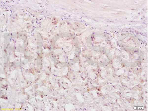 Formalin-fixed and paraffin embedded mouse stomach labeled with Anti-XAF1/FBXO39 Polyclonal Antibody, Unconjugated (bs-1308R) at 1:200 followed by conjugation to the secondary antibody and DAB staining.