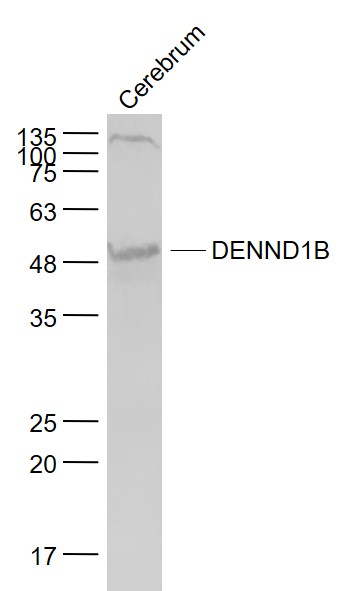 Mouse cerebrum lysates probed with DENND1B Polyclonal Antibody, Unconjugated (bs-8254R) at 1:1000 dilution and 4˚C overnight incubation. Followed by conjugated secondary antibody incubation at 1:20000 for 60 min at 37˚C.