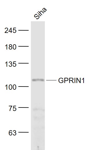Siha cell lysates probed with GPRIN1 Polyclonal Antibody, Unconjugated (bs-8275R) at 1:1000 dilution and 4˚C overnight incubation. Followed by conjugated secondary antibody incubation at 1:20000 for 60 min at 37˚C.