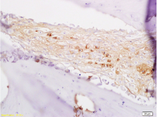 Formalin-fixed and paraffin embedded rabbit alveolar bone labeled with Anti-BMP7 Polyclonal Antibody, Unconjugated (bs-2242R) at 1:200 followed by conjugation to the secondary antibody and DAB staining.