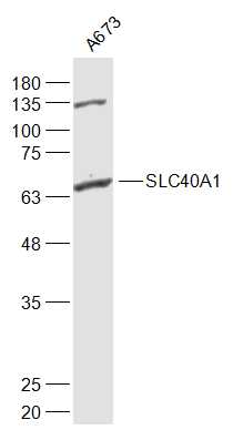 Lane 1: Human A673 Cells; 30ug loaded into lane; Probed with SLC40A1 Polyclonal Antibody, Unconjugated (bs-4906R) at 1:1000 overnight at 4°C followed by a conjugated secondary antibody for 60 minutes at 37°C.