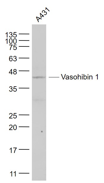 A431 cell lysates probed with Vasohibin 1 Polyclonal Antibody, Unconjugated (bs-1505R) at 1:1000 dilution and 4˚C overnight incubation. Followed by conjugated secondary antibody incubation at 1:20000 for 60 min at 37˚C.