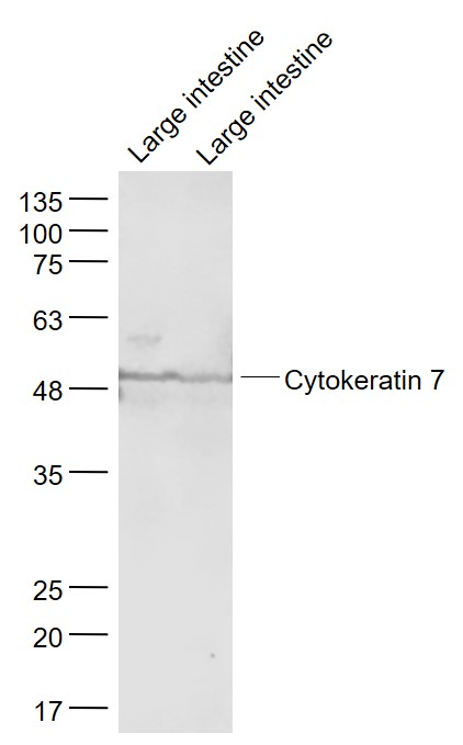 Lane 1: Mouse large intestine lysates; Lane 2: Rat large intestine lysates probed with CK7 Polyclonal Antibody, Unconjugated (bs-1744R) at 1:1000 dilution and 4˚C overnight incubation. Followed by conjugated secondary antibody incubation at 1:20000 for 60 min at 37˚C.