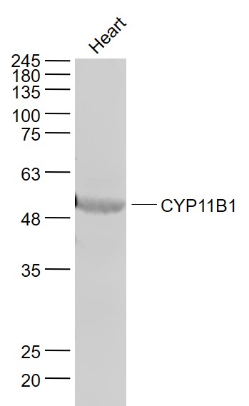Mouse heart lysates probed with CYP11B1 Polyclonal Antibody, Unconjugated (bs-3898R) at 1:1000 dilution and 4˚C overnight incubation. Followed by conjugated secondary antibody incubation at 1:20000 for 60 min at 37˚C. Mouse heart lysates probed with CYP11B1 Polyclonal Antibody, Unconjugated (bs-3898R) at 1:1000 dilution and 4˚C overnight incubation. Followed by conjugated secondary antibody incubation at 1:20000 for 60 min at 37˚C.