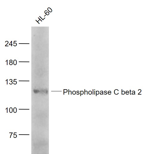 HL60 cell lysates probed with Phospholipase C beta 2 Polyclonal Antibody, Unconjugated (bs-6472R) at 1:1000 dilution and 4˚C overnight incubation. Followed by conjugated secondary antibody incubation at 1:20000 for 60 min at 37˚C.