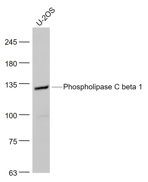U2OS cell lysates probed with Phospholipase C beta 1 Polyclonal Antibody, Unconjugated (bs-6976R) at 1:1000 dilution and 4˚C overnight incubation. Followed by conjugated secondary antibody incubation at 1:20000 for 60 min at 37˚C. U2OS cell lysates probed with Phospholipase C beta 1 Polyclonal Antibody, Unconjugated (bs-6976R) at 1:1000 dilution and 4˚C overnight incubation. Followed by conjugated secondary antibody incubation at 1:20000 for 60 min at 37˚C.