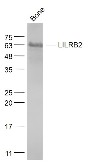 Mouse bone lysates probed with LILRB2 Polyclonal Antibody, Unconjugated (bs-7349R) at 1:1000 dilution and 4˚C overnight incubation. Followed by conjugated secondary antibody incubation at 1:20000 for 60 min at 37˚C. Mouse bone lysates probed with LILRB2 Polyclonal Antibody, Unconjugated (bs-7349R) at 1:1000 dilution and 4˚C overnight incubation. Followed by conjugated secondary antibody incubation at 1:20000 for 60 min at 37˚C.