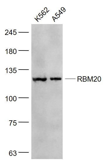 Lane 1: K562 cell lysates; Lane 2: A549 cell lysates probed with RBM20 Polyclonal Antibody, Unconjugated (bs-9606R) at 1:1000 dilution and 4˚C overnight incubation. Followed by conjugated secondary antibody incubation at 1:20000 for 60 min at 37˚C.