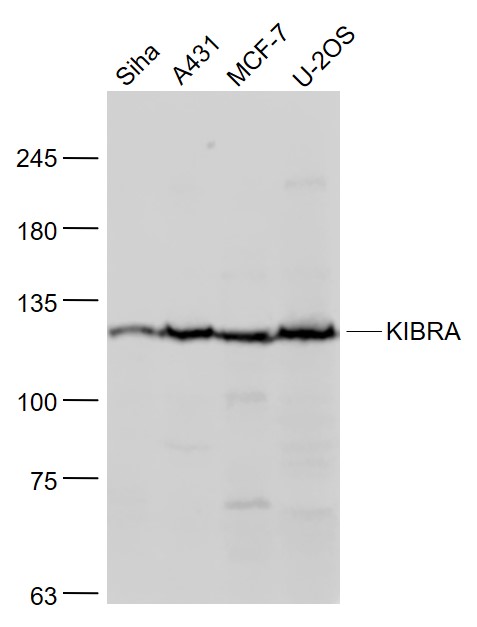 Lane 1: Siha cell lysates;Lane 2: A431 cell lysates;Lane 3: MCF-7 cell lysates; Lane 4: U2OS cell lysates probed with KIBRA Polyclonal Antibody, Unconjugated (bs-11570R) at 1:1000 dilution and 4˚C overnight incubation. Followed by conjugated secondary antibody incubation at 1:20000 for 60 min at 37˚C.