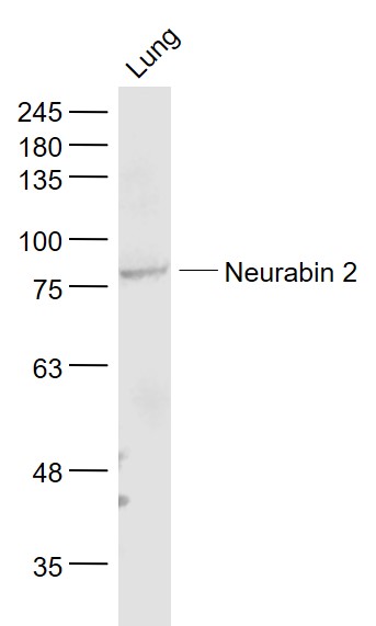 Mouse lung lysates probed with Neurabin 2 Polyclonal Antibody, Unconjugated (bs-12146R) at 1:1000 dilution and 4˚C overnight incubation. Followed by conjugated secondary antibody incubation at 1:20000 for 60 min at 37˚C.