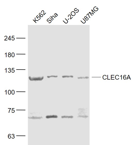 Lane 1: K562 cell lysates;Lane 2: Siha cell lysates;Lane 3: U2OS cell lysates; Lane 4: U87mg cell lysates probed with CLEC16A Polyclonal Antibody, Unconjugated (bs-18539R) at 1:1000 dilution and 4˚C overnight incubation. Followed by conjugated secondary antibody incubation at 1:20000 for 60 min at 37˚C. Lane 1: K562 cell lysates;Lane 2: Siha cell lysates;Lane 3: U2OS cell lysates; Lane 4: U87mg cell lysates probed with CLEC16A Polyclonal Antibody, Unconjugated (bs-18539R) at 1:1000 dilution and 4˚C overnight incubation. Followed by conjugated secondary antibody incubation at 1:20000 for 60 min at 37˚C.