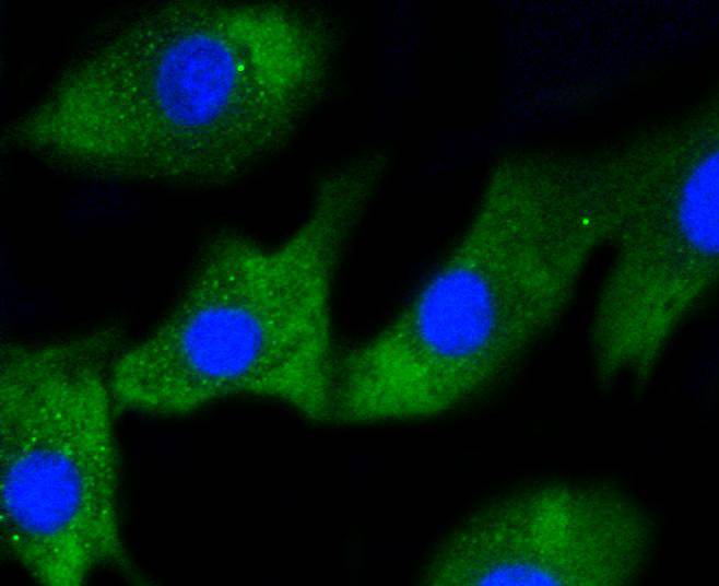 NIH/3T3 cells were fixed in paraformaldehyde, permeabilized with 0.25% Triton X100/PBS and stained with IRF1 (3G7) Monoclonal Antibody (bsm-52114R) at 1:100 and incubated overnight at 4C, followed by secondary antibody incubation, DAPI staining of the nuclei and detection.