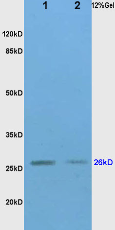 Lane 1: Mouse Brain; Lane 2: Mouse Liver; 30ug loaded into the lane; Probed with TIMP-1 Polyclonal Antibody, Unconjugated (bs-0415R) at 1:200 overnight at 4\u00b0C followed by a conjugated secondary antibody for 60 minutes at 37\u00b0C.