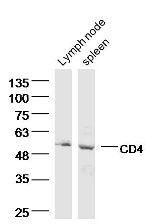 Lane 1: Mouse Lymph Node; Lane 2: Mouse Spleen; 40ug loaded into each lane; Probed with CD4 Polyclonal Antibody, Unconjugated (bs-0766R) at 1:300 dilution and 4˚C overnight incubation. Followed by conjugated secondary antibody incubation at 1:10000 for 60 min at 37˚C.