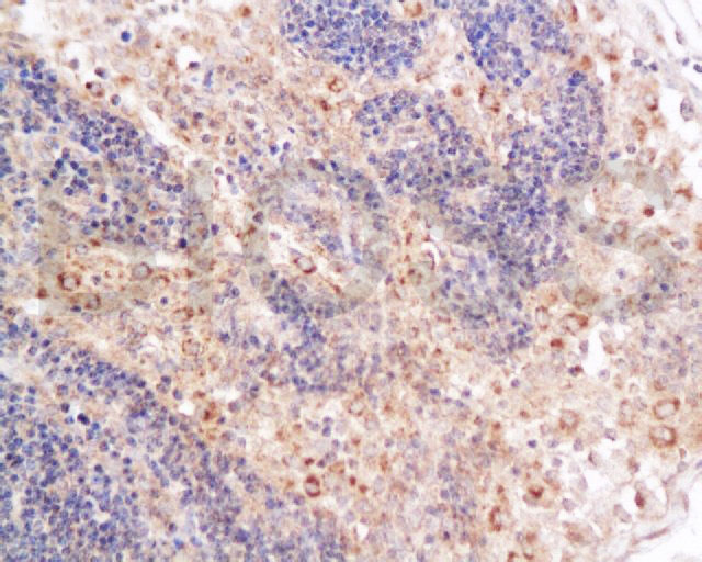 Tissue/cell: Mouse Lymphoma tissue; 4% Paraformaldehyde-fixed and paraffin-embedded; Antigen retrieval: citrate buffer (0.01M, pH 6.0), Boiling bathing for 15min; Block endogenous peroxidase by 3% Hydrogen peroxide for 30min; Blocking buffer (normal goat serum) at 37℃ for 20 min; Incubation: CD4 Polyclonal Antibody, Unconjugated (bs-0766R) 1:200, overnight at 4°C, followed by incubation with secondary antibody and DAB staining